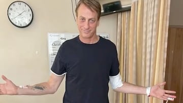 Tony Hawk abre los brazos en el hospital tras romperse fu f&eacute;mur, en marzo del 2022. 