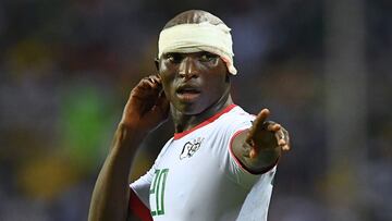 Burkina Faso&#039;s defender Yacouba Coulibaly reacts as he resumes play following a head injury during the 2017 Africa Cup of Nations group A football match between Gabon and Burkina Faso at the Stade de l&#039;Amitie Sino-Gabonaise in Libreville on Janu