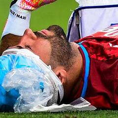 David Ospina tendrá días de descanso después del golpe