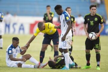 El mediocampista hondureño sufrió una impactante lesión, luego de que Javier Aquino le cayó encima de la pierna en una jugada sin intención en el duelo de Concacaf.