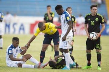 El mediocampista hondureño sufrió una impactante lesión, luego de que Javier Aquino le cayó encima de la pierna en una jugada sin intención en el duelo de Concacaf.