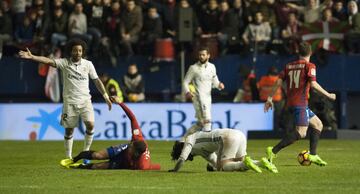 Se fractur¨® tibia y peron¨¦ al chocar fortuitamente con Isco en el partido Osasuna-Real Madrid.