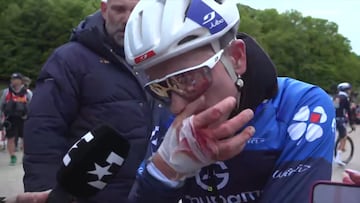 David Gaudu con su mano vendada tras la caída.