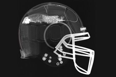 Seau, Easterling, Duerson y la lección moral de Bob