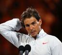 Nadal: "Tengo la espalda clavada, pero no es nada grave"