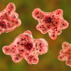 What is the brain-eating amoeba found in Iowa? Is it deadly? Symptoms and treatment