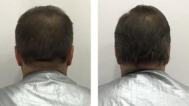 Los tres beneficios de usar aceite de romero (natural y anticaída) en tu pelo y barba