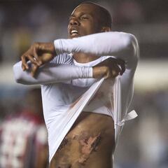 Las cicatrices de guerra en la carrera de Jonathan Copete