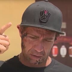 El surfista mordido en la cara: "Fue como caer en una trampa para osos"