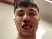 Absurdo: un hincha invade el campo y le rompe la nariz a Bianco