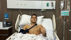 Duarte, operado con éxito