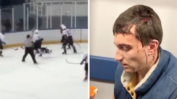 La tremenda agresión a un jugador de hockey: ¡terminó con la cabeza abierta!