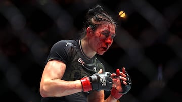 LAS VEGAS, NEVADA - SEPTEMBER 14: Irene Aldana of Mexico is cut during her fight against Norma Dumont of Brazil during UFC 306: Riyadh Season Noche at Sphere on September 14, 2024 in Las Vegas, Nevada.   Christian Petersen/Getty Images/AFP (Photo by Christian Petersen / GETTY IMAGES NORTH AMERICA / Getty Images via AFP)