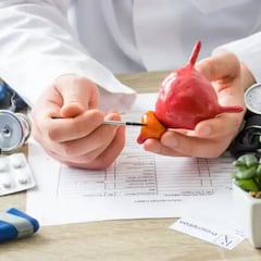 El tipo de cáncer que se duplicará en 2040