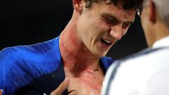 Rudiger apologises for stamp on France defender Pavard