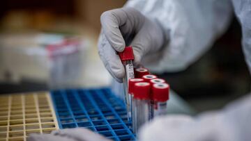 A laboratory technician works on COVID 19 samples, on October 12, 2020 in VetAgro Sup National Veterinary National School in Marcy l'Etoile. (Photo by JEFF PACHOUD / AFP)