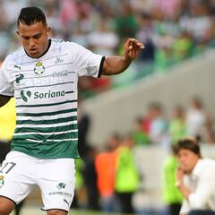 Santos confirmó terrible fractura de Javier Cortés