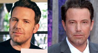 Ben Affleck aparece con nueva cara tras pasar por quirófano