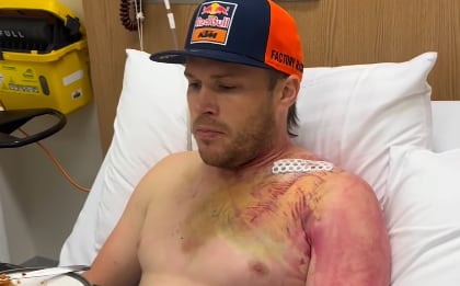 Daniel Sanders se opera de la clavícula tras la fractura que sufrió en el Dakar.