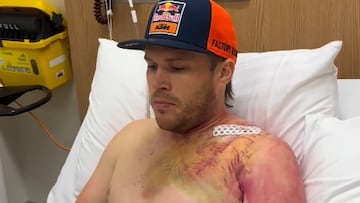 Daniel Sanders se opera de la clavícula tras la fractura que sufrió en el Dakar.