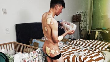 Roglic ense?a sus heridas: ¡°Memorias de la Itzulia...¡±