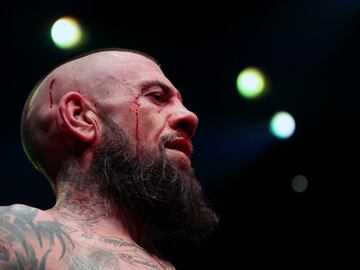 El BKB (Bare-knuckle boxing) es el deporte del boxeo sin el uso de guantes de boxeo u otro acolchado en las manos de los participantes.