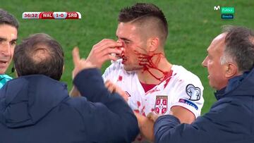 Taylor rompió la nariz a Tadic de un patadón involuntario