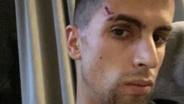 Cancelo es asaltado en su casa