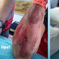 Laia Sanz decide retirarse por su "fea herida" en el brazo