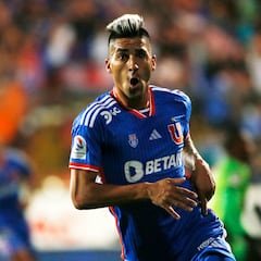 La U explica la situación médica de Fernández y qué debe ocurrir para que vuelva