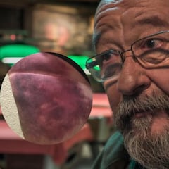 El actor Pep Cruz muestra sus daños tras ser atropellado por un patinete eléctrico