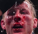 ¡Espeluznante! Así quedó la cara de Paddy Pimblett tras la pelea con Gaethje