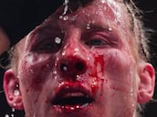 ¡Espeluznante! Así quedó la cara de Paddy Pimblett tras la pelea con Gaethje