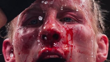 La cara ensangrentada de Paddy Pimblett.