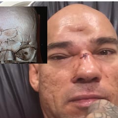 Pokeballs, cráneos hundidos y puro show: Michael Venom Page vuelve a UFC para frenar a Shara Bullet