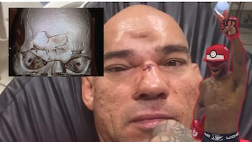 Pokeballs, cráneos hundidos y puro show: Michael Venom Page vuelve a UFC para frenar a Shara Bullet