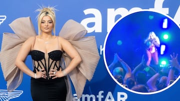 Bebe Rexha had to leave a concert on Sunday night after being hit in the face with a cell phone. She required several stitches for the wound.