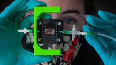 Crean un parche para diabéticos que produce insulina