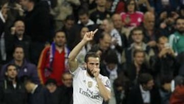 Nacho: "No quise ponerla ahí"