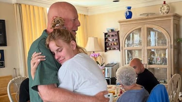 Bruce Willis suffered a serious hearing injury in his most iconic film that accelerated his dementia, according to his wife