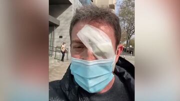 Operan de urgencia a Pablo Motos de un orzuelo