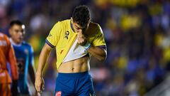 Por culpa de un hongo, Sebastián Cáceres no puede jugar con América