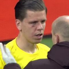 Szczesny se llevó un tremendo golpe en el 1-0 de Cristiano