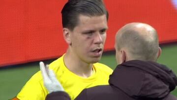 Szczesny se llevó un tremendo golpe en el 1-0 de Cristiano