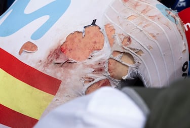 Ivan Romeo, llegó a meta con el lado derecho ensangrentado después de sufrir una caída durante la etapa 20 del Tour de Francia.