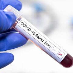 Test rápido del coronavirus: cómo funciona y cuánto tarda