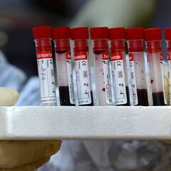 Test preventivos: los médicos del fútbol piden una aclaración