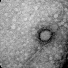 Coronavirus: ¿cuánto tiempo tardaron en desaparecer el SARS y el MERS?