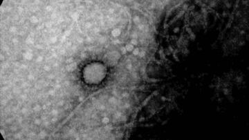 Coronavirus: ¿cuánto tiempo tardaron en desaparecer el SARS y el MERS?