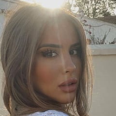 Marina muestra una foto previa a la cirugía, con solo 14 años: "Estaba acomplejada"